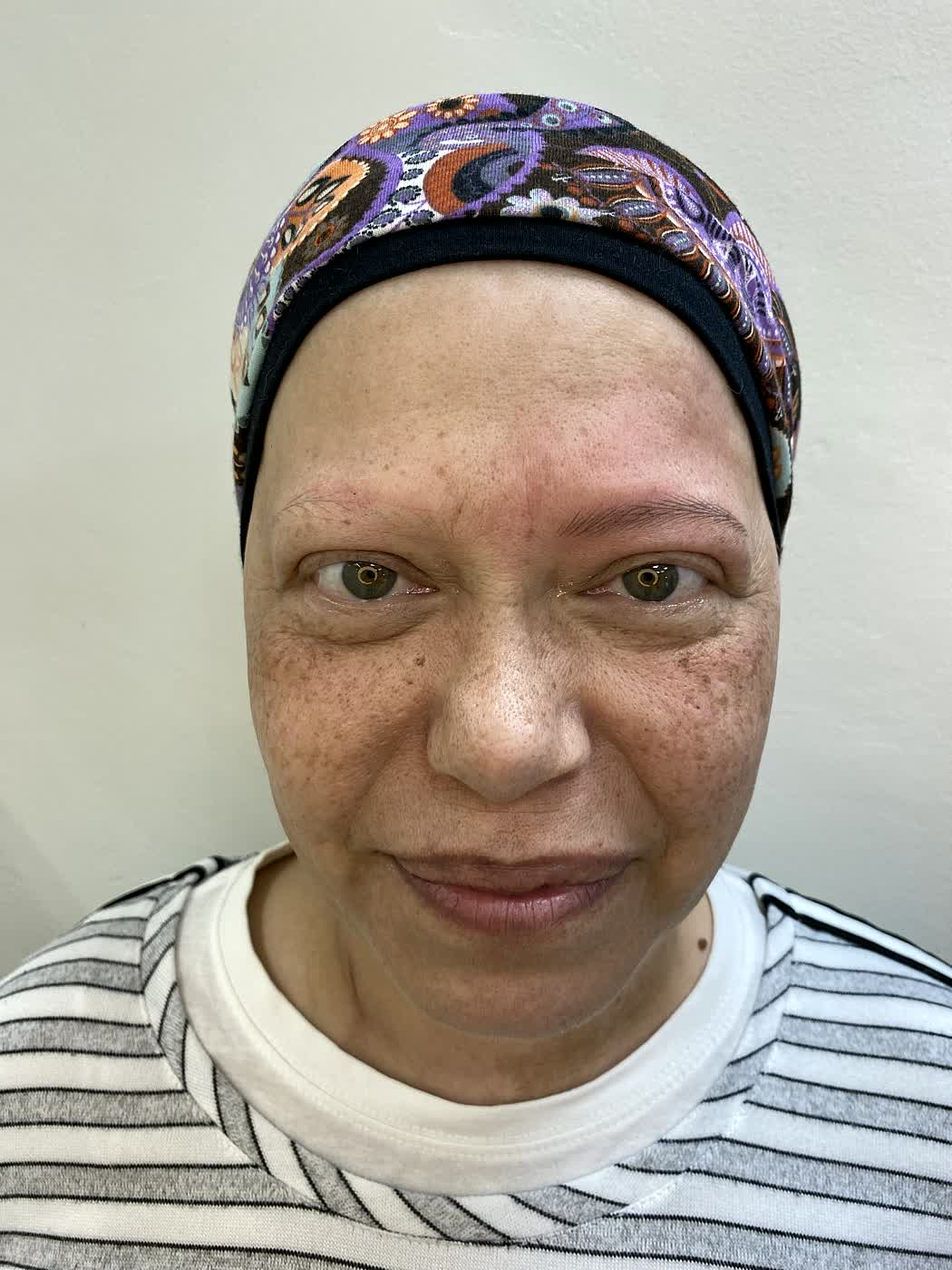 Después del tratamiento de cejas en clienta adulta