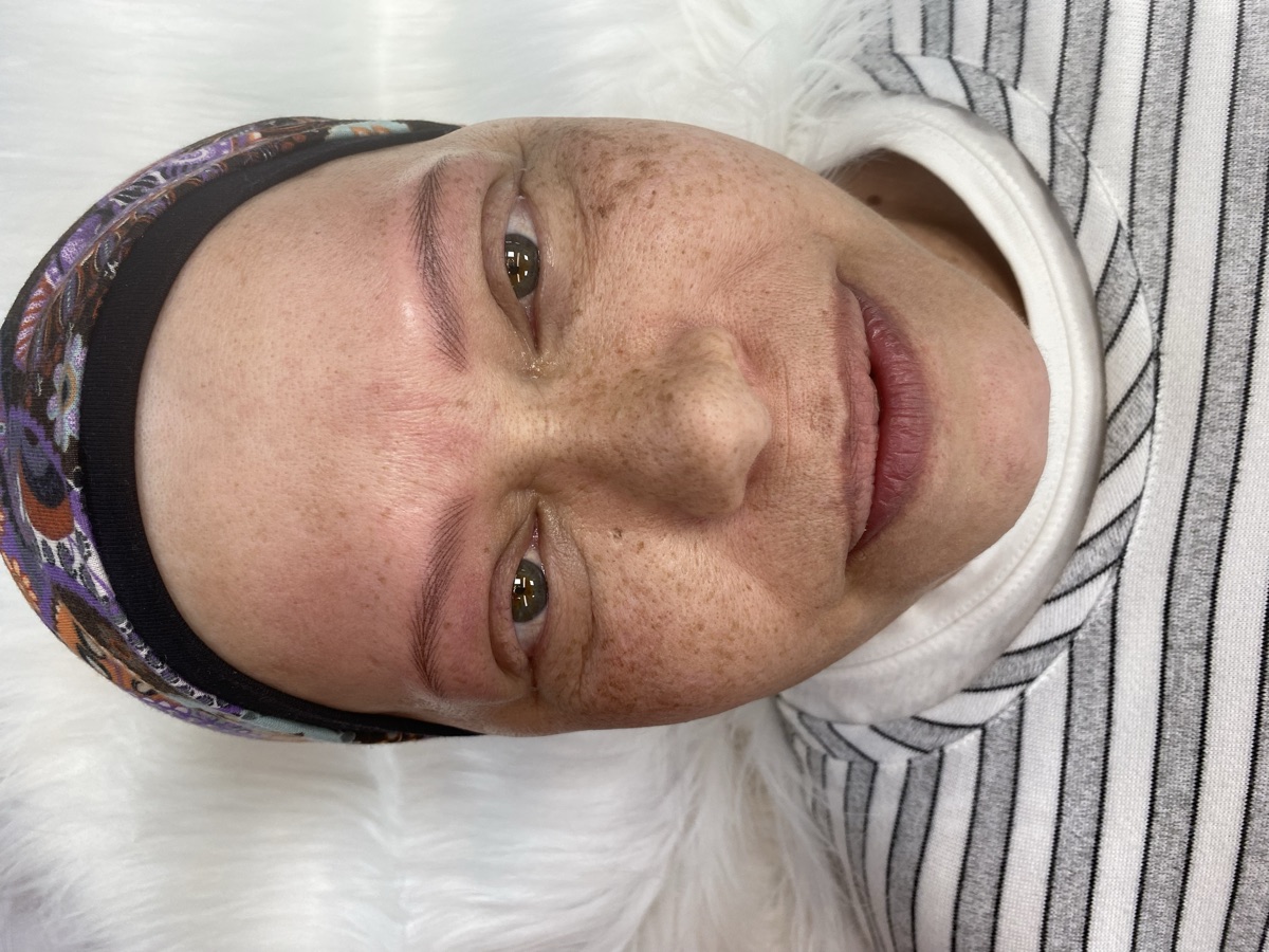 Primer plano de resultado en cejas