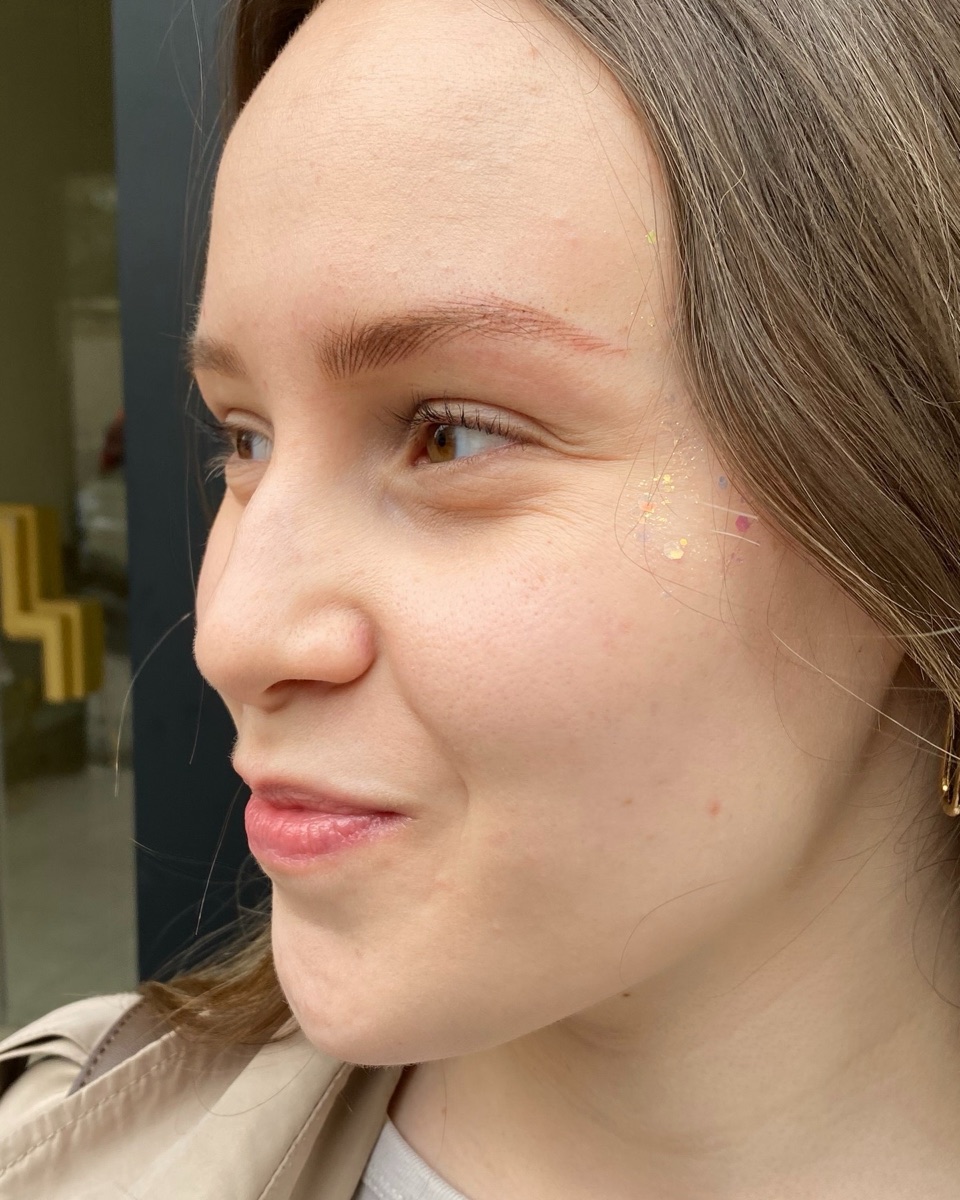Perfil lateral después del diseño de cejas